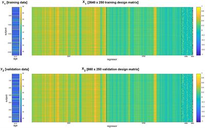 Distributional Transformation Improves Decoding Accuracy When Predicting Chronological Age From Structural MRI